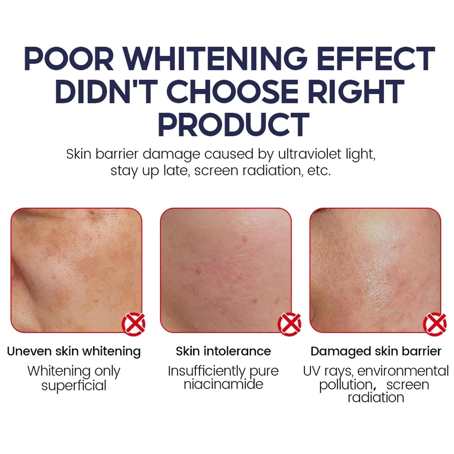 Niacinamide Whitening Face Toner 5X Ceramide Skin Barrier Repair Brightening Glowing Skin Fades Dark Spot