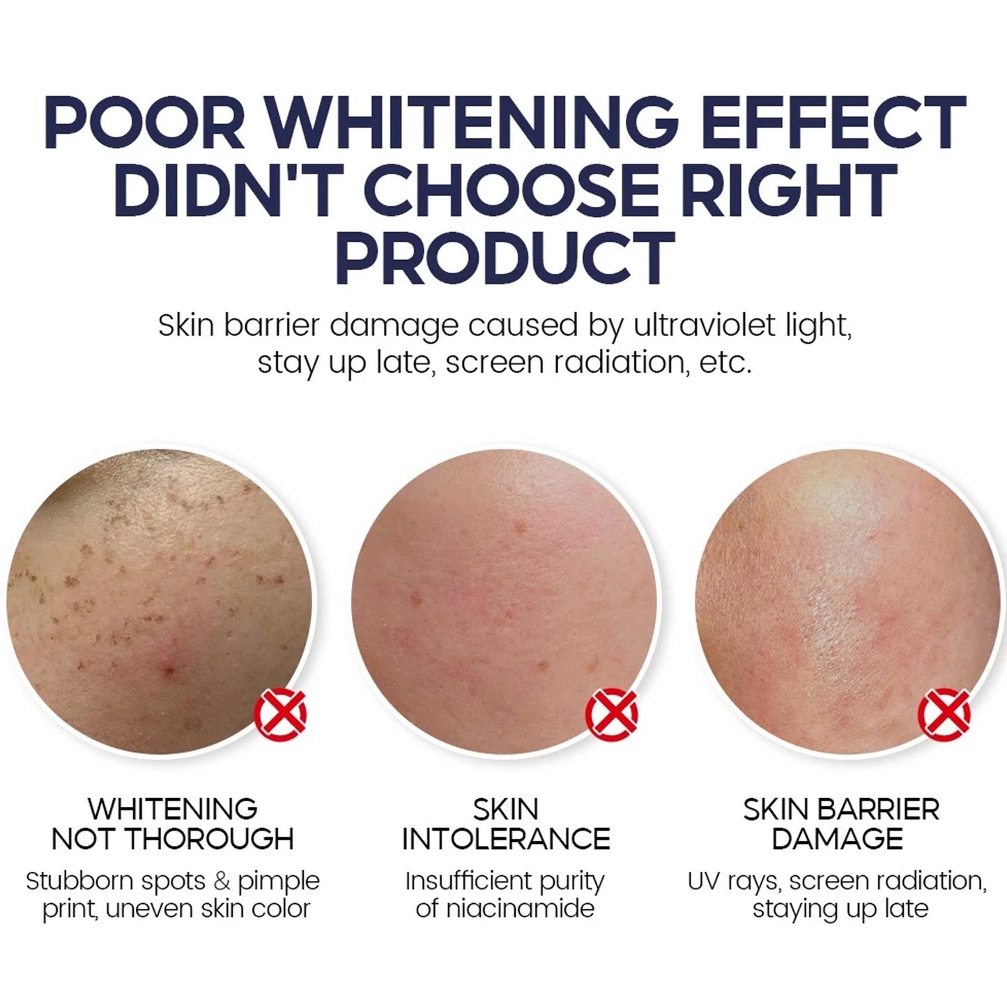 Niacinamide Whitening Face Moisturizer 5X Ceramide Skin Barrier Repair Redness Dryness Brightening Glowing Skin