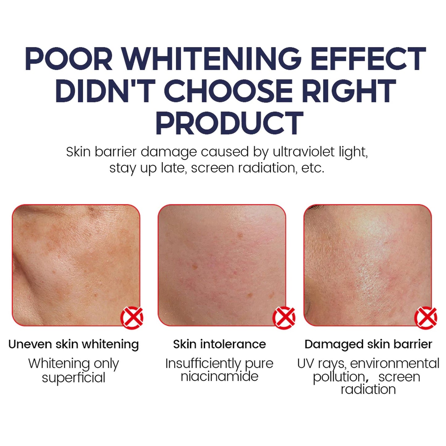 Anti Aging Whitening Set Retinol Face Cream Niacinamide Toner Serum 5X Ceramide 3X Centella Asiatica Skin Barrier