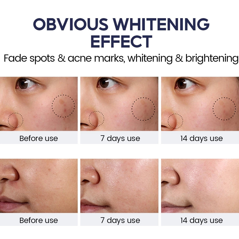 Niacinamide Whitening Face Cream 5X Ceramide Skin Barrier Repair Face Moisturiser Brightening Day Cream