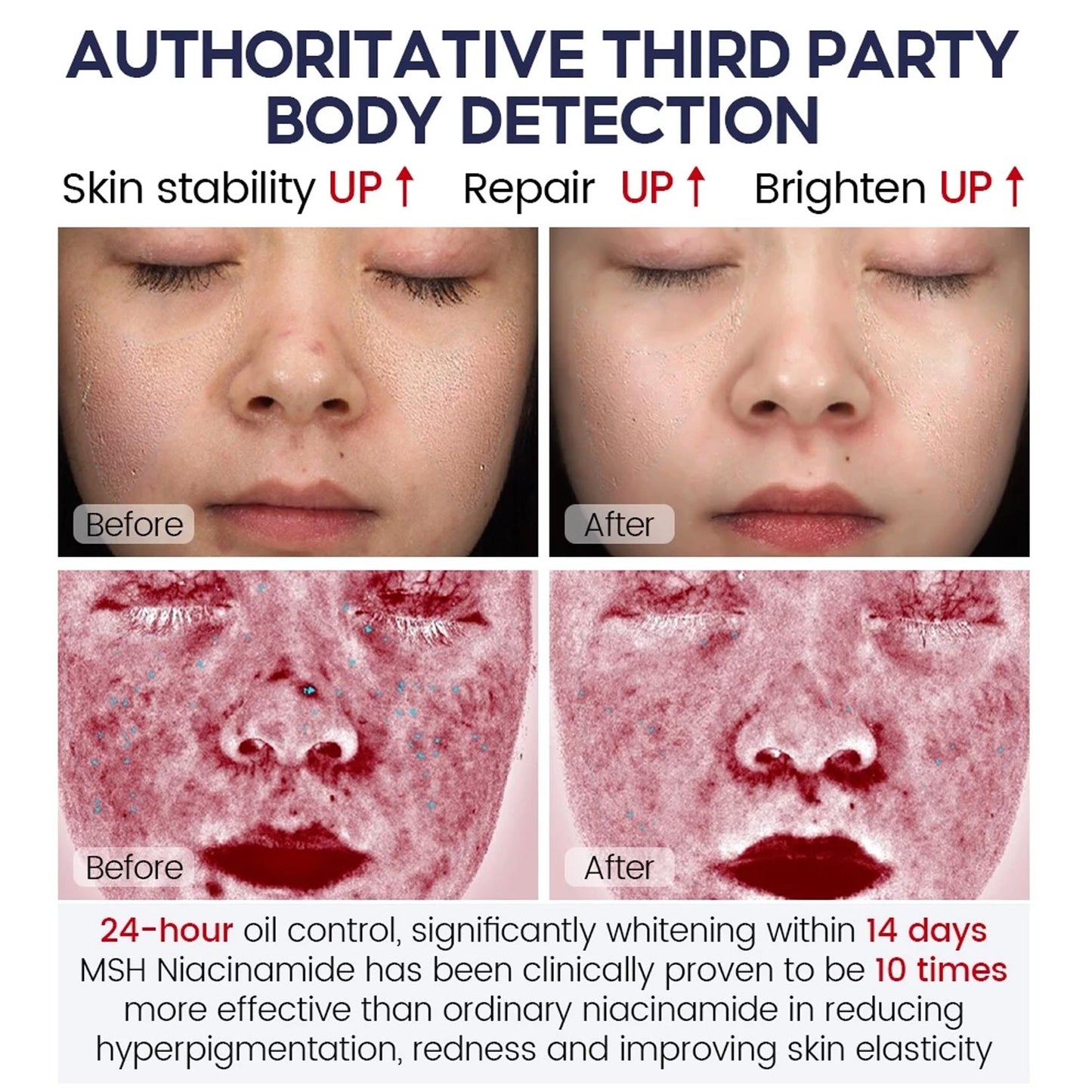 Niacinamide Whitening Face Moisturizer 5X Ceramide Skin Barrier Repair Redness Dryness Brightening Glowing Skin