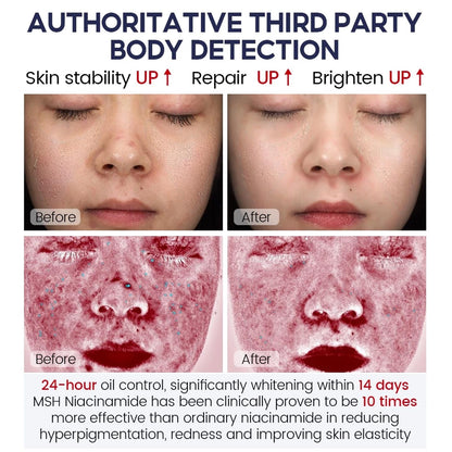 Niacinamide Whitening Face Moisturizer 5X Ceramide Skin Barrier Repair Redness Dryness Brightening Glowing Skin