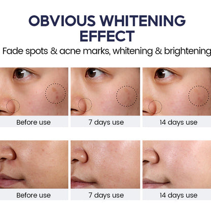 Anti Aging Whitening Set Retinol Face Cream Niacinamide Toner Serum 5X Ceramide 3X Centella Asiatica Skin Barrier