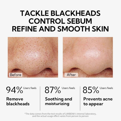 Lanbena Black Heads Nose Strip Remover