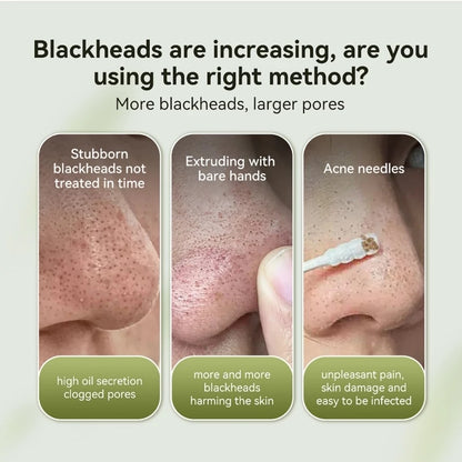 Lanbena Black Heads Nose Strip Remover